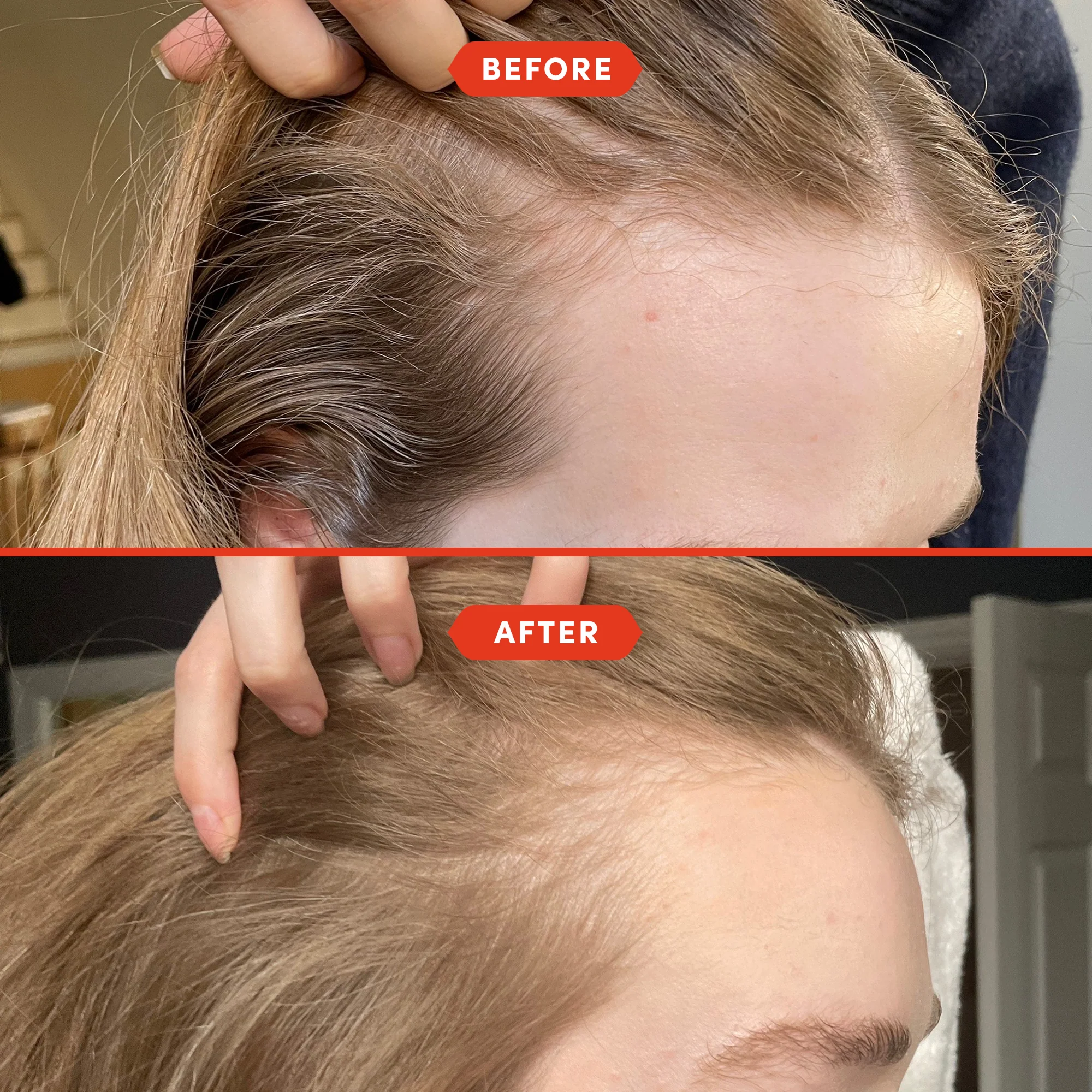 Mini HoliRoots™ Hair Oil - Image 5